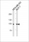 ACE2 (NCOVID / SARS Receptor) Antibody (Center)(Ascites)