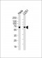 FUBP3 Antibody (N-term)