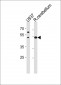 SLC25A25 Antibody (N-term)