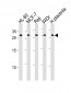 CLIC1 Antibody (Center)