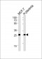 PRLR Antibody (Center)