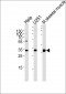 POLR2C Antibody (C-term)