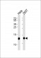 VAMP8 Antibody (N-term)