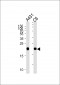 NRAS Antibody (N-term)