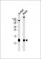 B2M Antibody