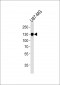 ITGB1 Antibody