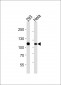 MSH2 Antibody (Center)