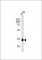 OTX2 Antibody (C-term)