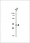 STUB1 Antibody (C-term)