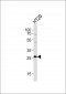 NNMT Antibody (Center)