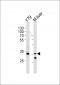 CSDA Antibody (Center)