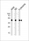 ACTA1/Alpha-actin Antibody (C-term)