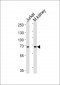 TCF12 Antibody (N-term)