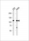 SALL4 Antibody (C-term)