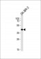 SOX8 Antibody (Center)