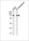 EPM2AIP1 Antibody (N-term)