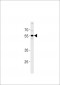 PPHLN1 Antibody (N-term)