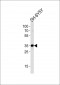 STX1B Antibody (N-term)