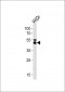 KRT20 Antibody (C-term)