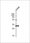 EXOSC2 Antibody(N-term)