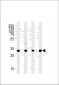 HOXB2 Antibody (C-term)