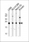 UCHL1 Antibody (C-term)