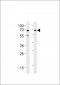 Ubiquilin1 (PLIC1) Antibody (N-term)