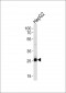 SIRT3 Antibody (C-term)