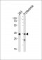 STUB1 Antibody (C-term)
