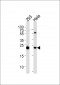 IL1RN Antibody (C-term)