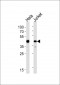 ACTR2 Antibody (Center)