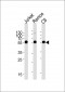 CALR Antibody (Center)