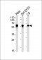 CALR Antibody