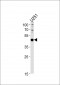 PAX6 Antibody (Center)