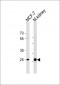 CA2 Antibody (N-term)