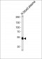 SERPINF1 Antibody (Center)