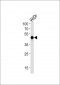 HNF4G Antibody (N-term)