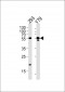 ALDH1A3 Antibody (N-term)