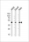 ALDH3A1 Antibody (Center)