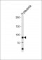 AMPD3 Antibody (Center)