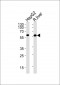 GCK Antibody (N-term)