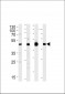 MEK1 (MAP2K1) Antibody (N-term)