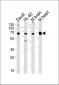 PACSIN2 Antibody (C-term)