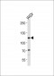 CARD6 Antibody (Center)