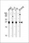 GSTP1 Antibody (Center)