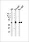 PDK2 Antibody