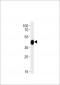 DANREchst11 Antibody (Center)
