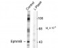 Phospho-Tyr317 EphrinB Antibody
