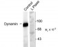 Phospho-Ser778 Dynamin Antibody