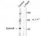 Phospho-Tyr331 EphrinB Antibody